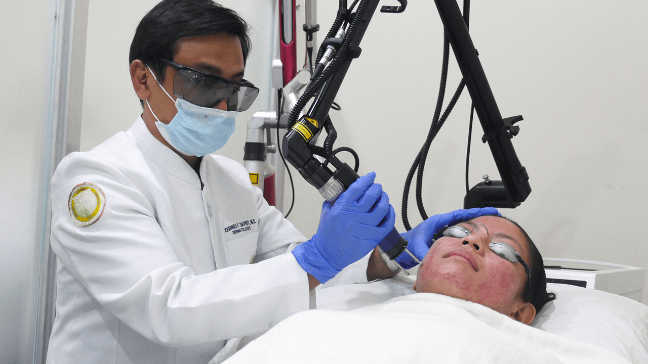 CO2 and Erbium:YAG fractional resurfacing lasers for scars